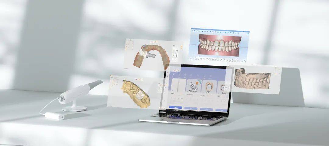 國內首家齒科數字化CAD/CAM軟硬件研發企業落戶拱墅，推動計算機系統集成創新發展